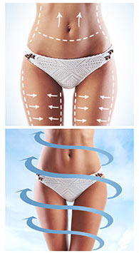 Better Way than to Lose Weight with Coolsculpting