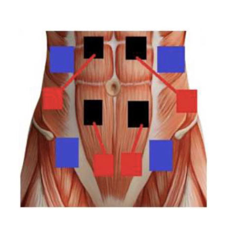 ice21 treatment diagram 1