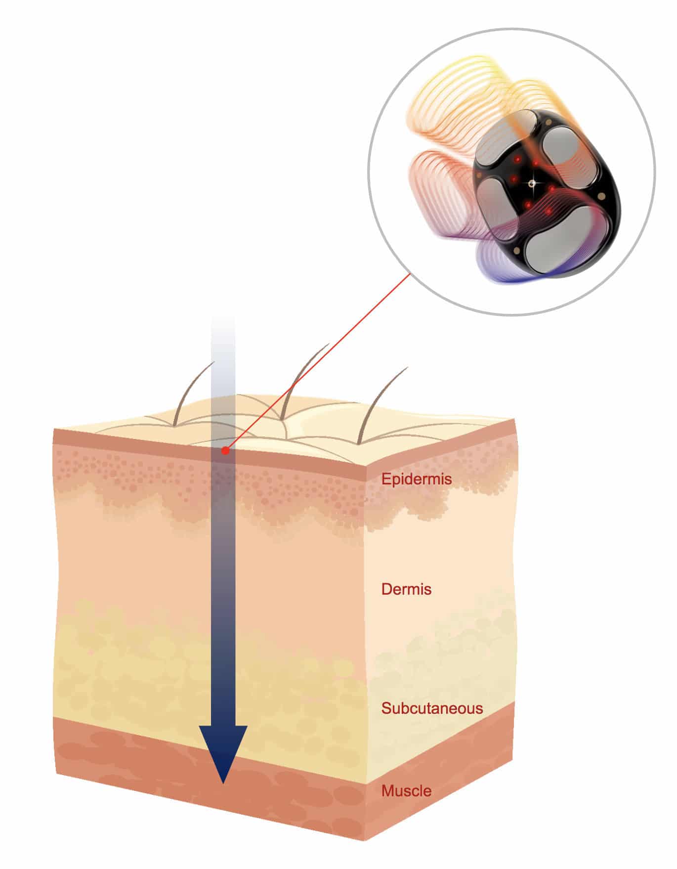 what-is-mid-frequency